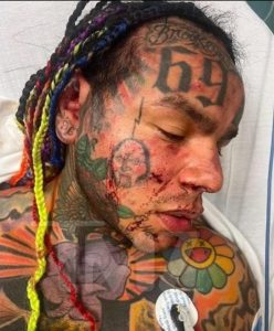 Tekashi 6ix9ine Bruised and Bloodied in Hospital After Being Jumped at Florida Gym